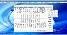 Sistema Para Clínica Odontologica + Código Fonte Em Delphi